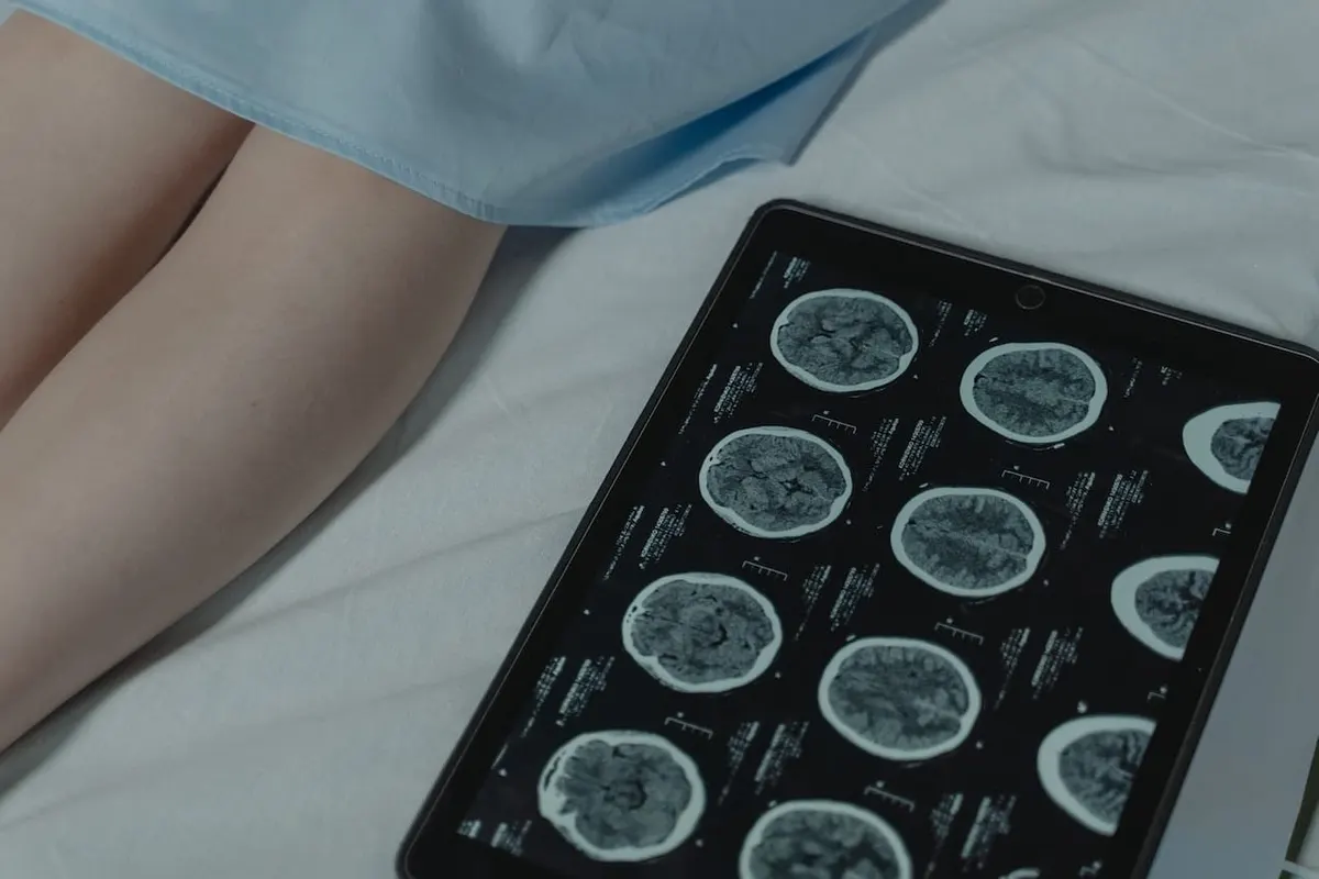 ภาพ x-ray ไปหมอ รักษา