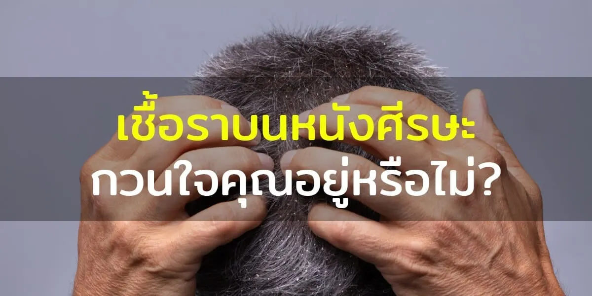 5 วิธีการรักษาและอาการเชื้อราบนหนังศีรษะ