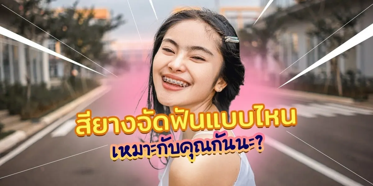 แนะนำ 13 สียางจัดฟันใครเหมาะกับสีแบบไหน